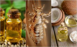 Cuidado de Cabello 23 shampoo eficaz para combatir piojos asegura tu paz