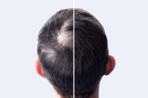 Cuidado de Cabello 27 aumenta el volumen y el cuerpo de tu cabello consejos para cabello debilitado