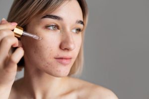 Cuidado de Cabello 24 elimina los puntos negros con estos consejos eficaces para una piel saludable y tersa